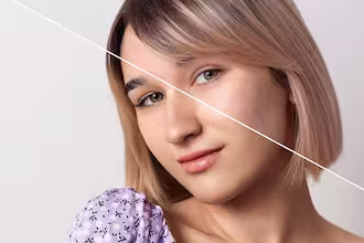 Cildin bir yarısı lekeli, diğer yarısı ise tedavi sonrası pürüzsüz olan kadın.
